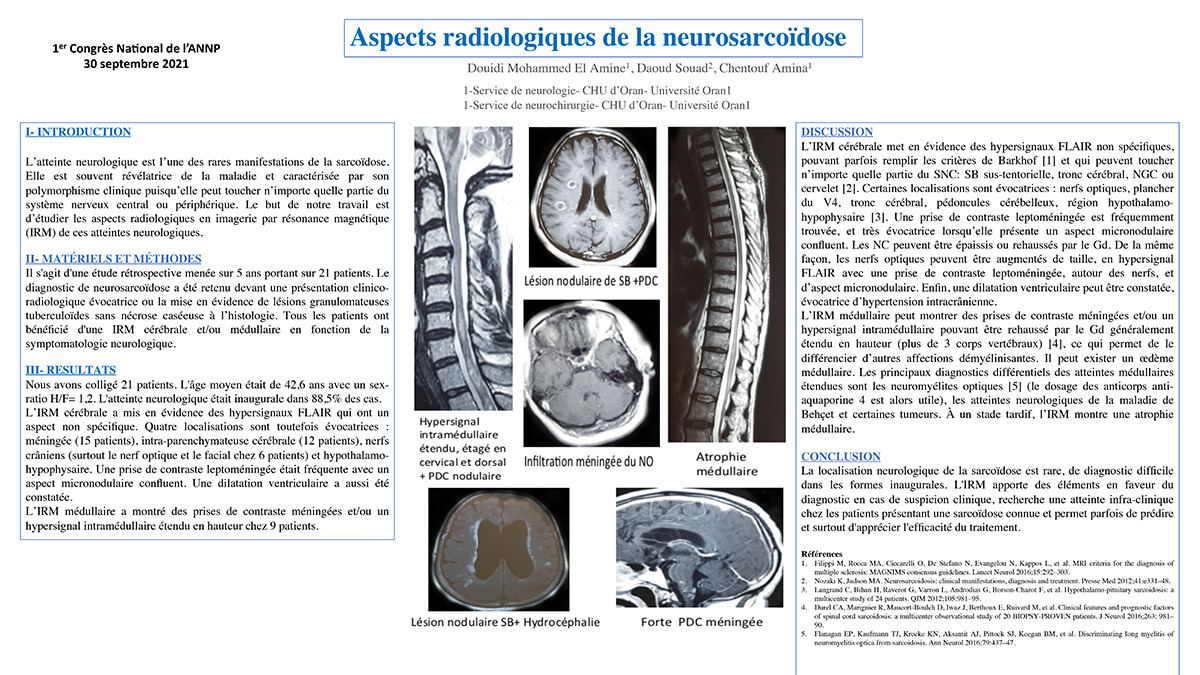 Aspects radiologiques de la neurosarcoïdose