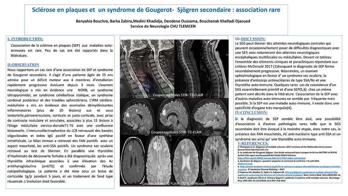 Sclérose en plaques et  un syndrome de Gougerot-  Sjögren secondaire : association rare