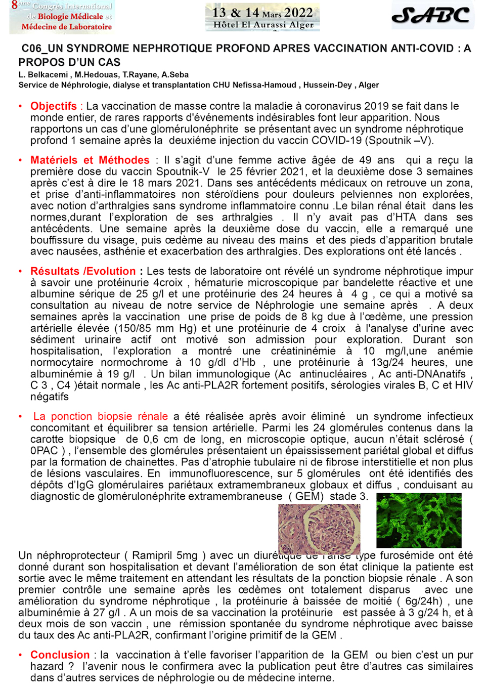 C06: UN SYNDROME NEPHROTIQUE PROFOND APRES VACCINATION ANTI-COVID : A PROPOS D’UN CAS