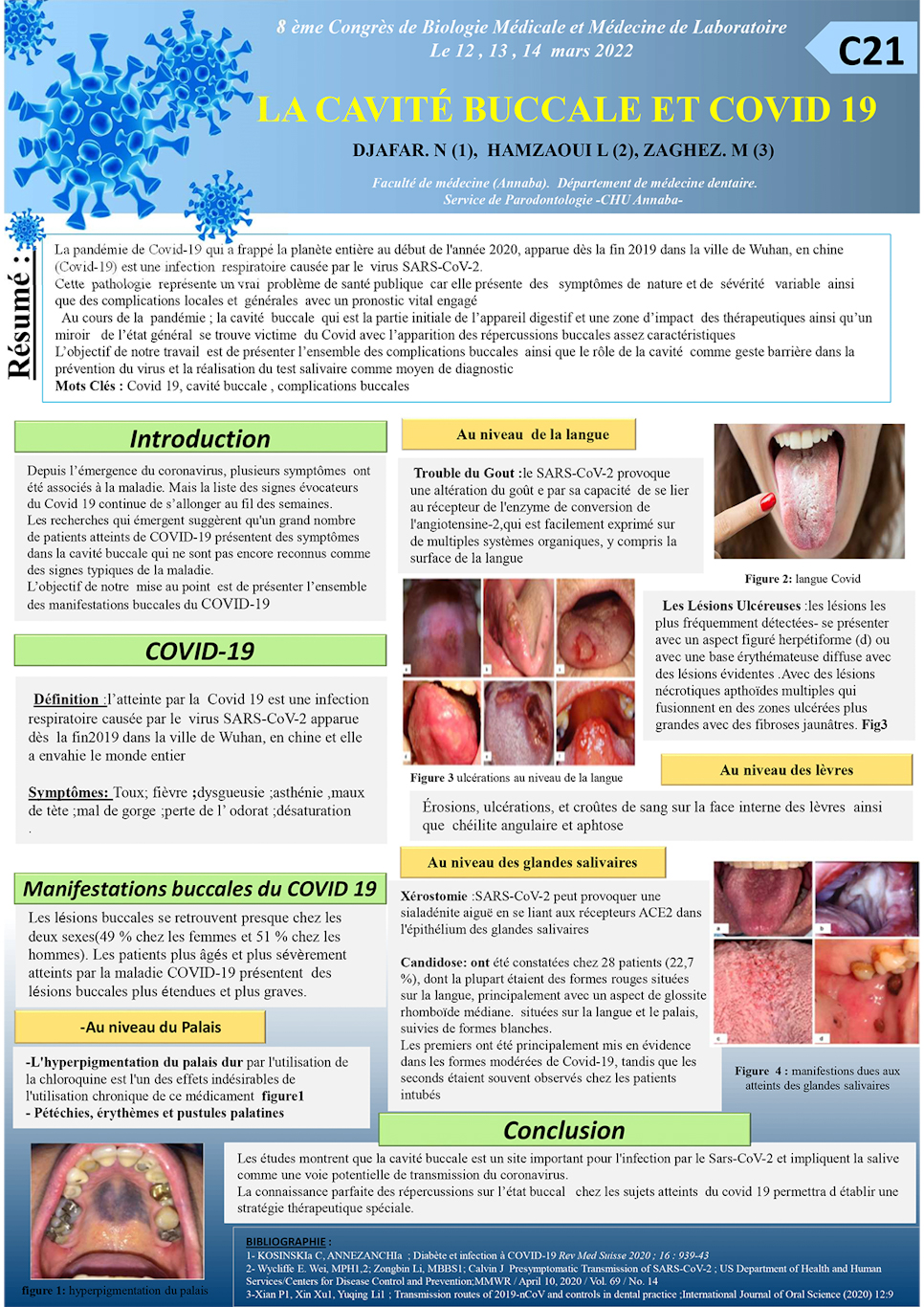 C21: LA CAVITÉ BUCCALE ET COVID 19