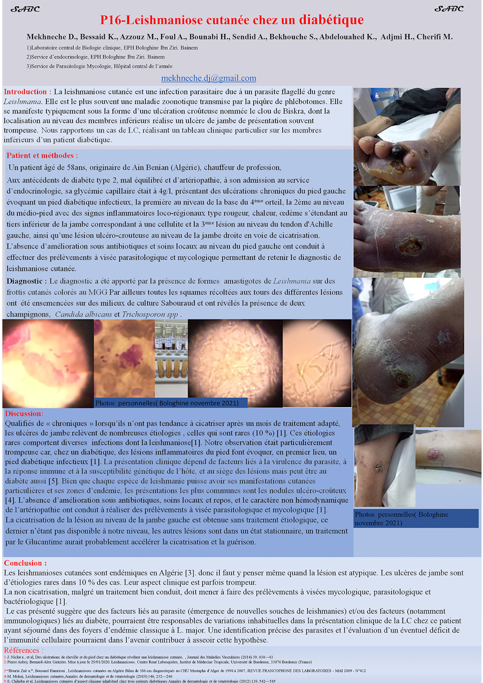 P16: Leishmaniose cutanée chez un diabétique