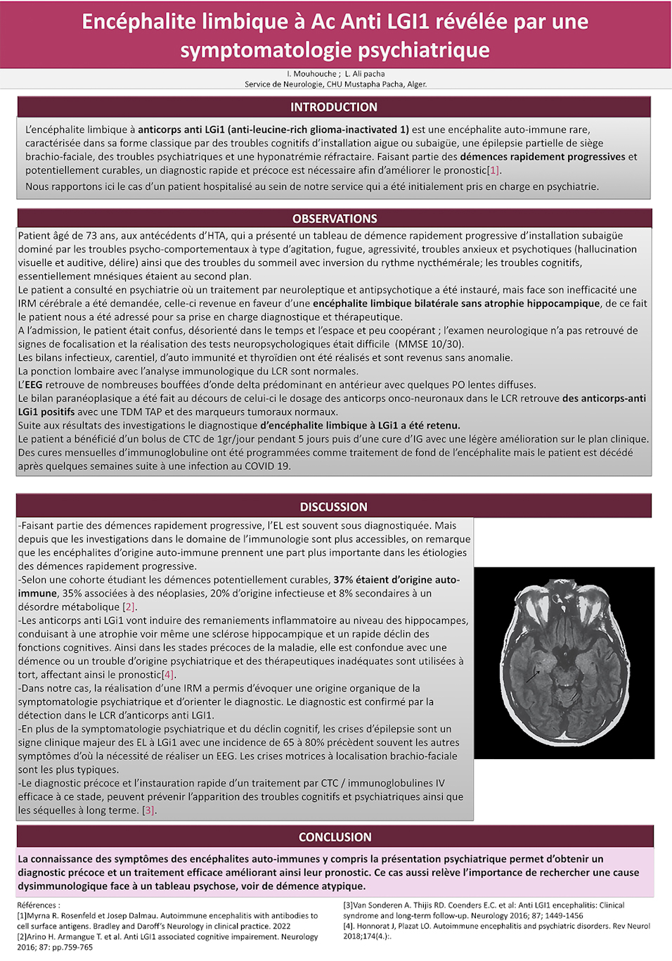 NV-1 Encéphalite limbique à Ac Anti LGI1 révélée par une symptomatologie psychiatrique