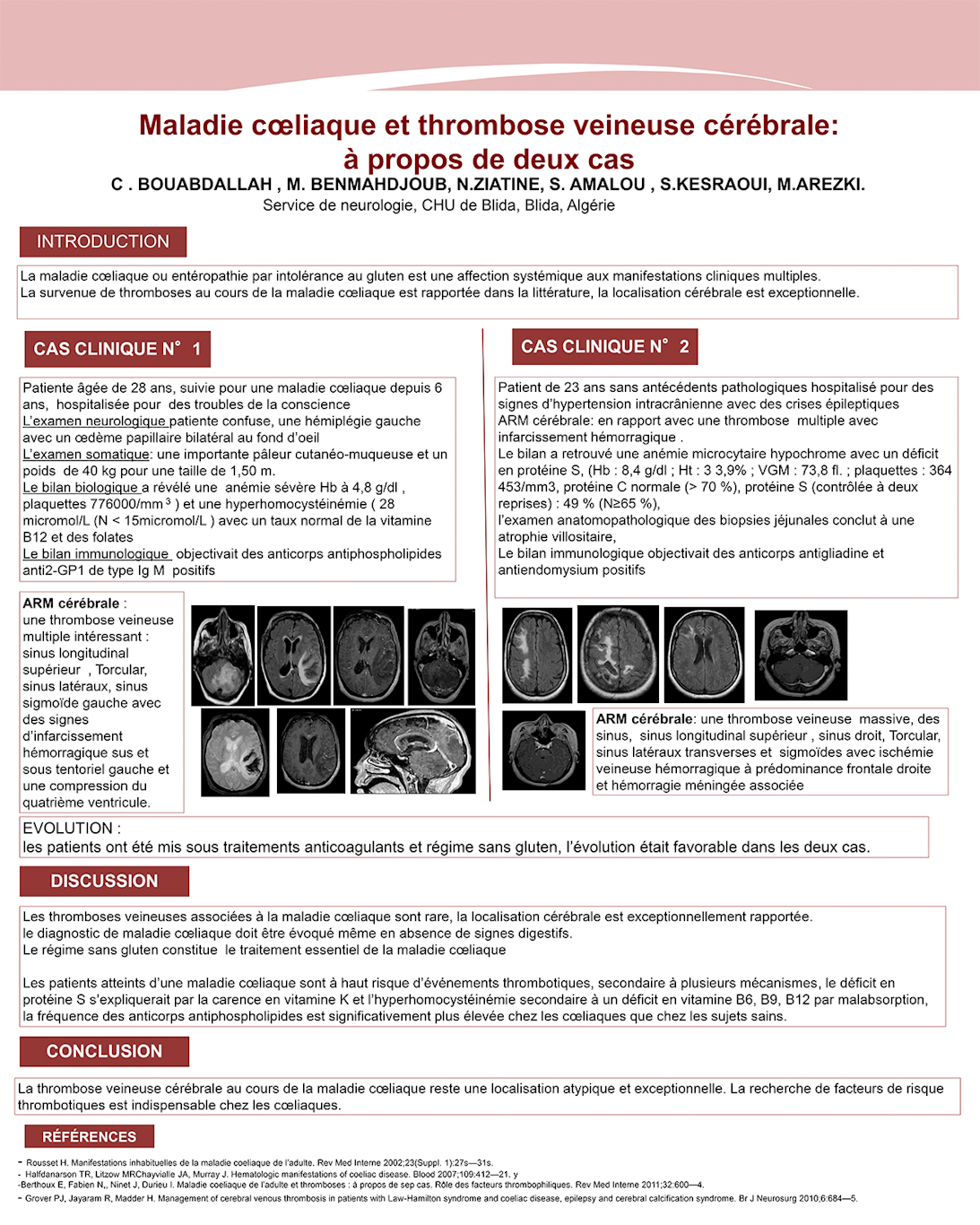 NV-19 Maladie cœliaque et thrombose veineuse cérébrale: à propos de deux cas.