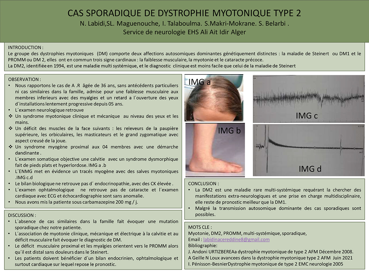 NV-21 Cas sporadique de dystrophie myotonique type 2 .