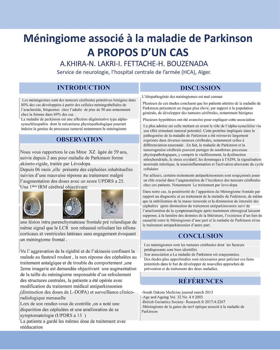 NV-38 Méningiome associé à la maladie de Parkinson, A propos d’un cas.