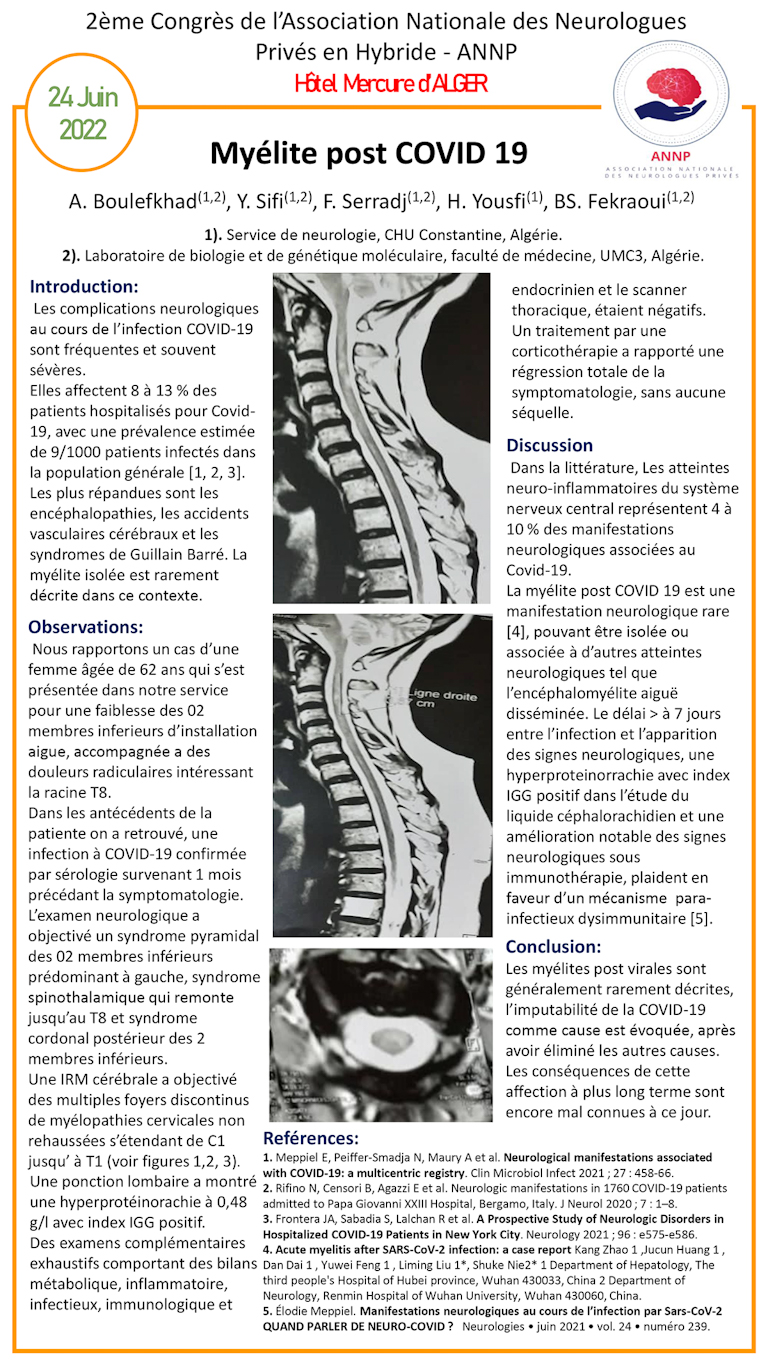 NV-43 Myélite post COVID 19.