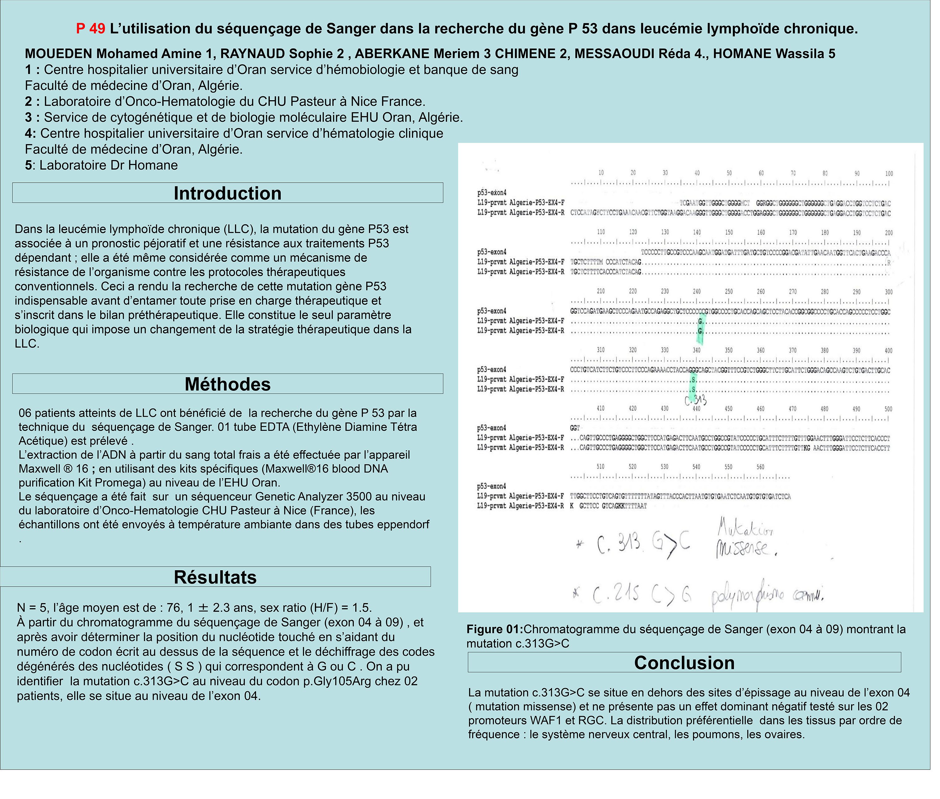 GENETIQUE : P49 - L’utilisation du séquençage de Sanger dans la recherche du gène P 53 dans leucémie lymphoïde chronique