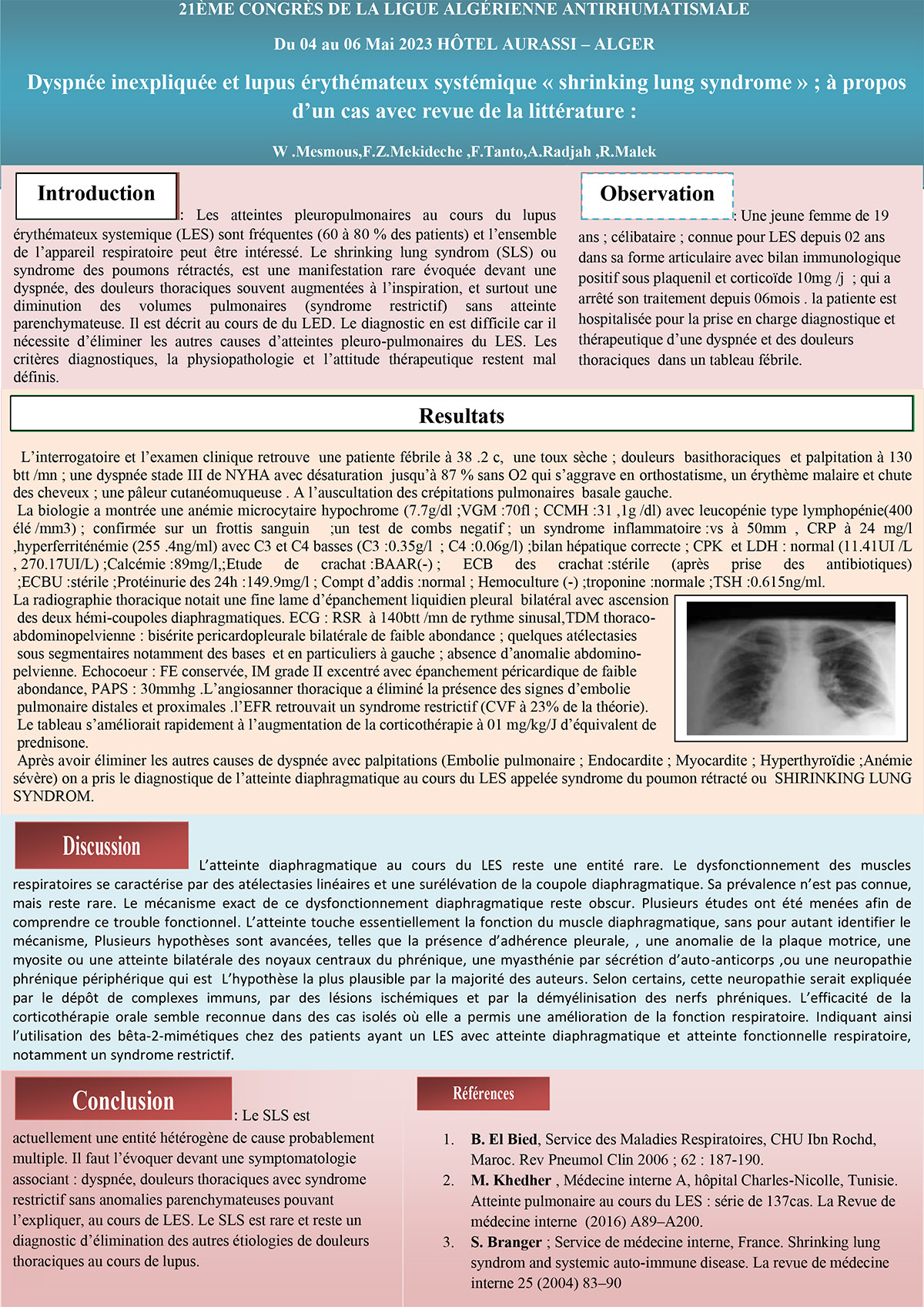 Dyspnée inexpliquée et lupus érythémateux systémique « shrinking lung syndrome » ; à propos  d’un cas avec revue de la littérature :