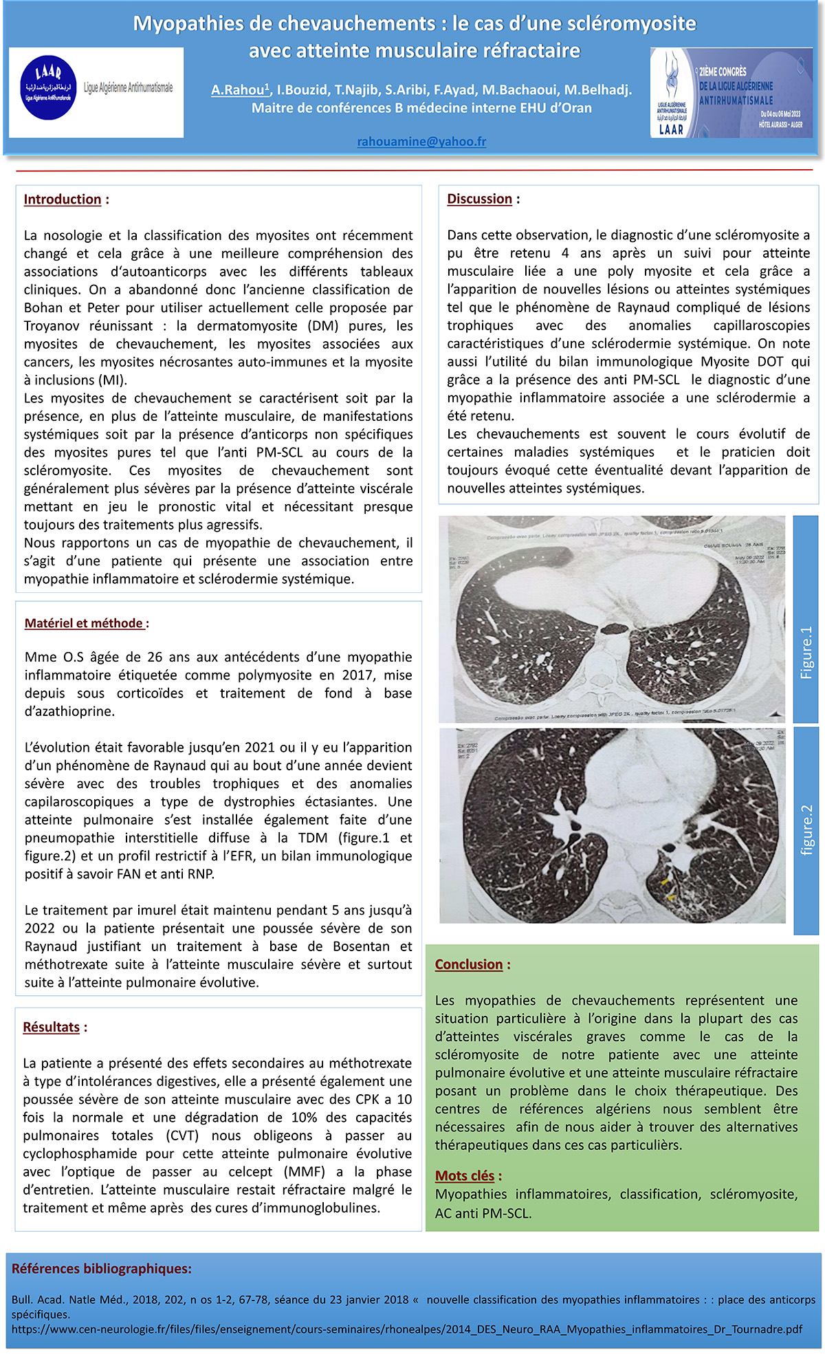 Myopathies de chevauchements : le cas d’une scléromyosite  avec atteinte musculaire réfractaire