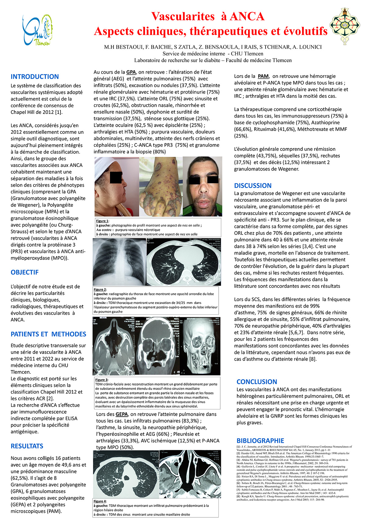 Vascularites à ANCA  Aspects cliniques, thérapeutiques et évolutifs