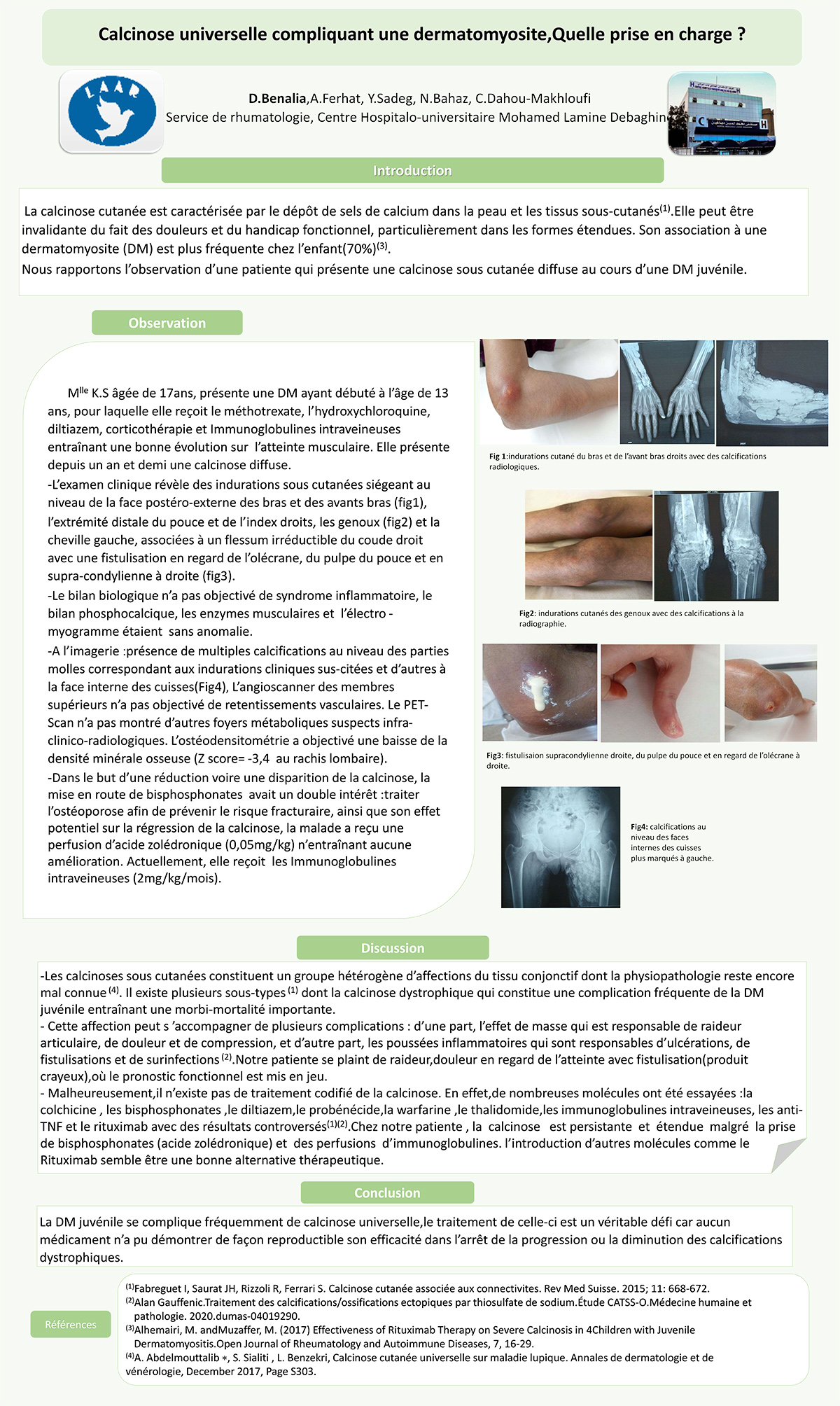 Calcinose universelle compliquant une dermatomyosite,Quelle prise en charge ?