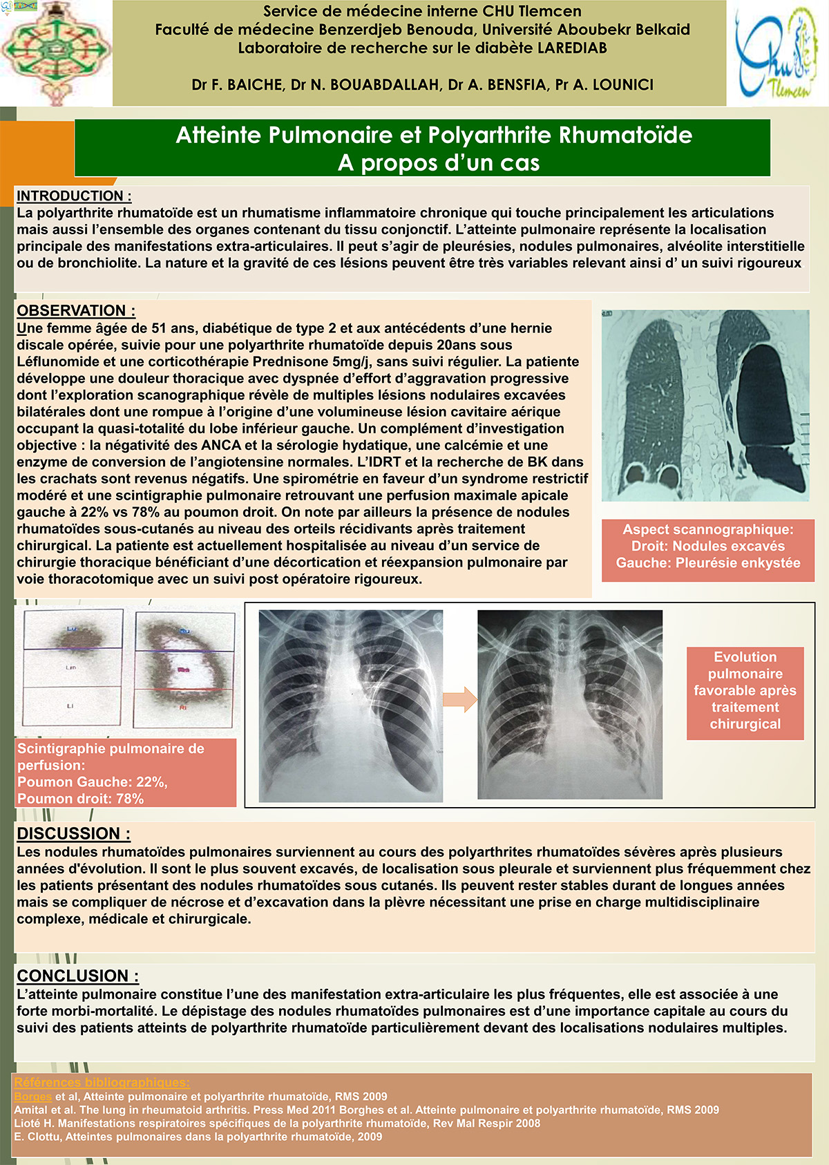 Atteinte Pulmonaire et Polyarthrite Rhumatoïde A propos d’un cas