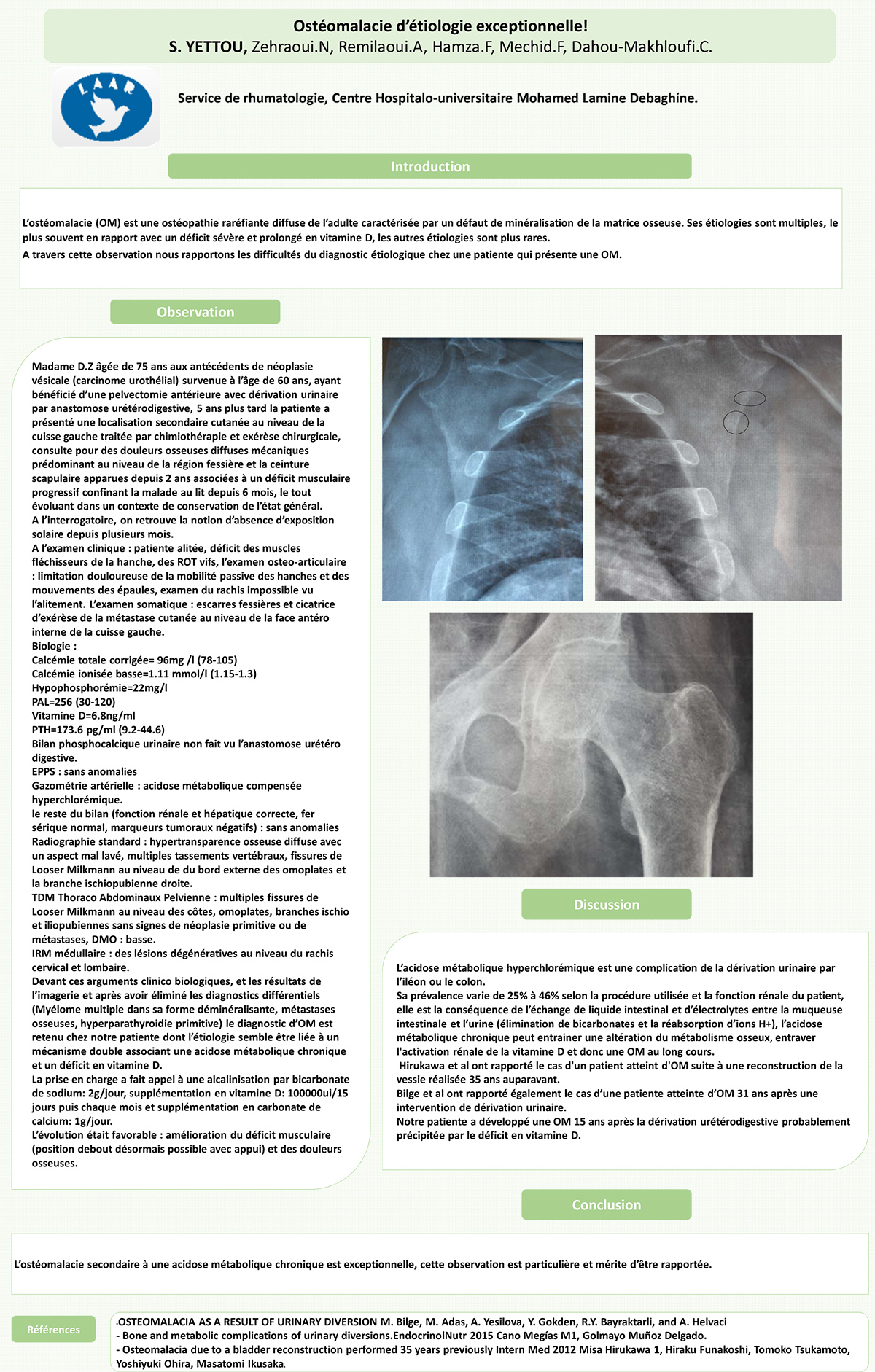 Ostéomalacie d’étiologie exceptionnelle!