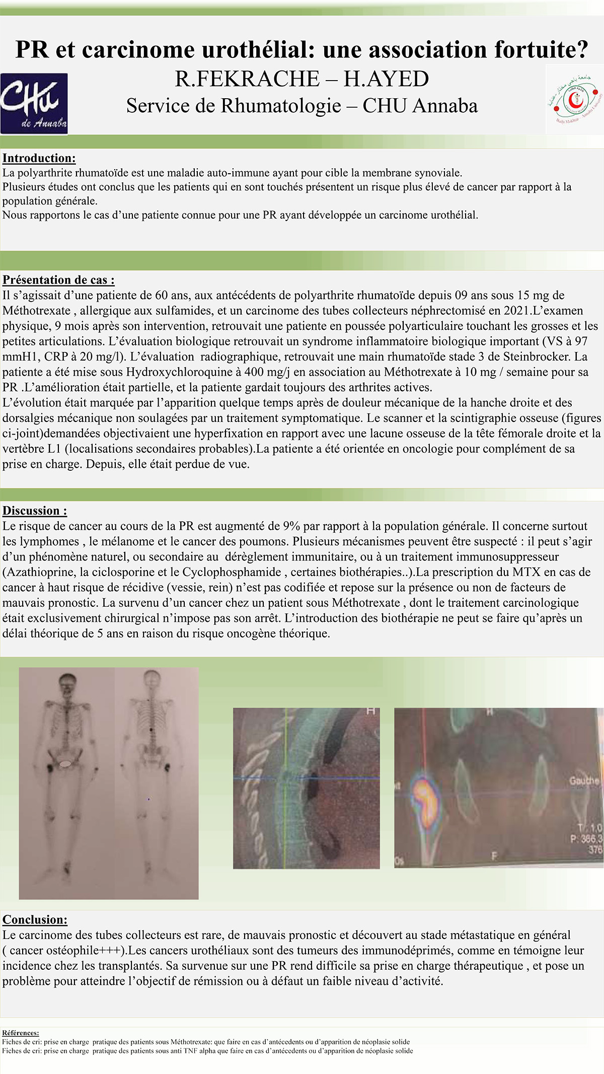 PR et carcinome urothélial: une association fortuite?