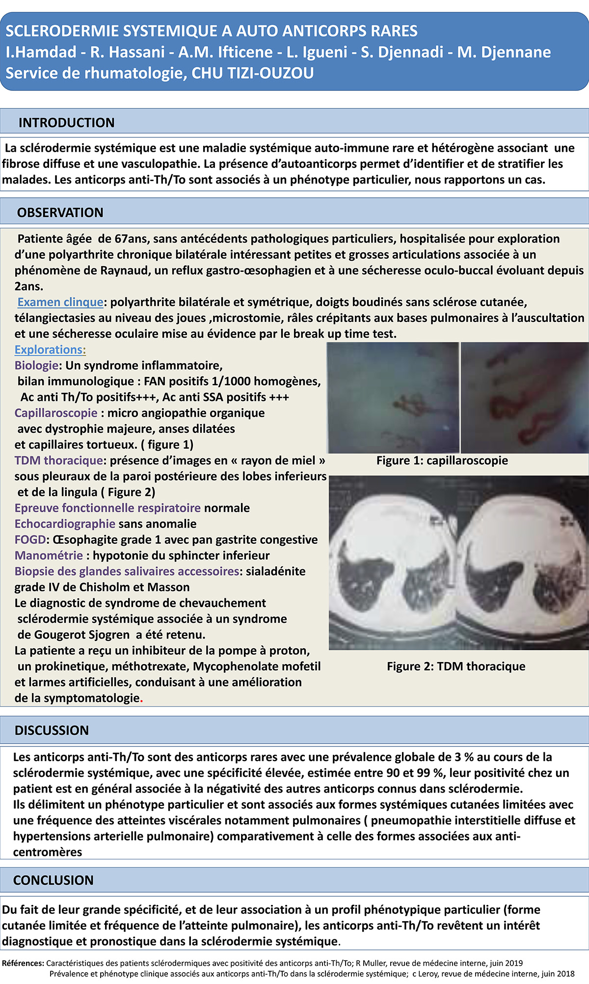 SCLERODERMIE SYSTEMIQUE A AUTO ANTICORPS RARES