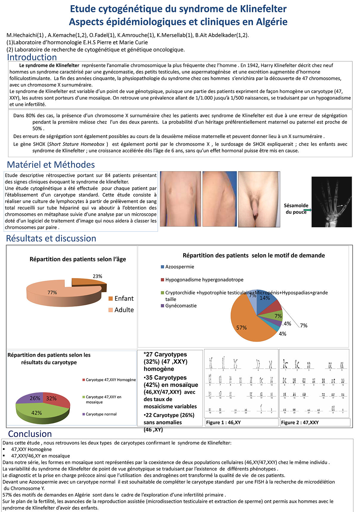 P120 : Etude cytogénétique du syndrome de Klinefelter Aspects épidémiologiques et cliniques en Algérie