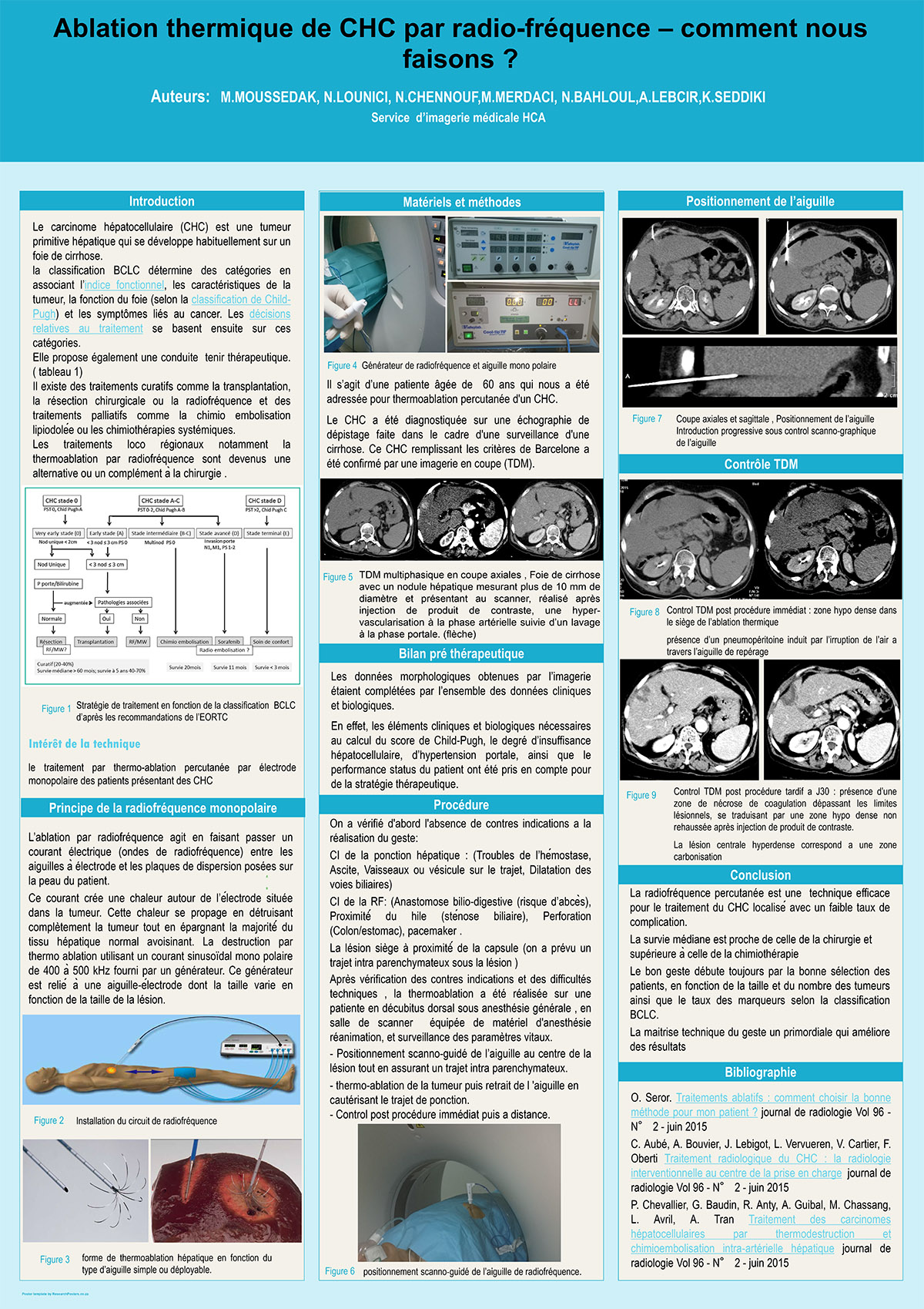 Ablation thermique de CHC par radio-fréquence – comment nous faisons ?