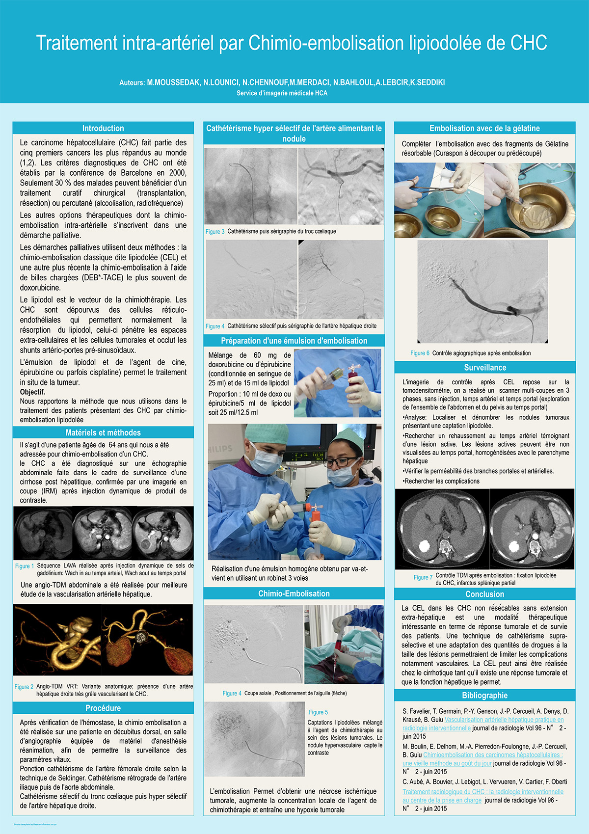 Traitement intra-artériel par Chimio-embolisation lipiodolée de CHC