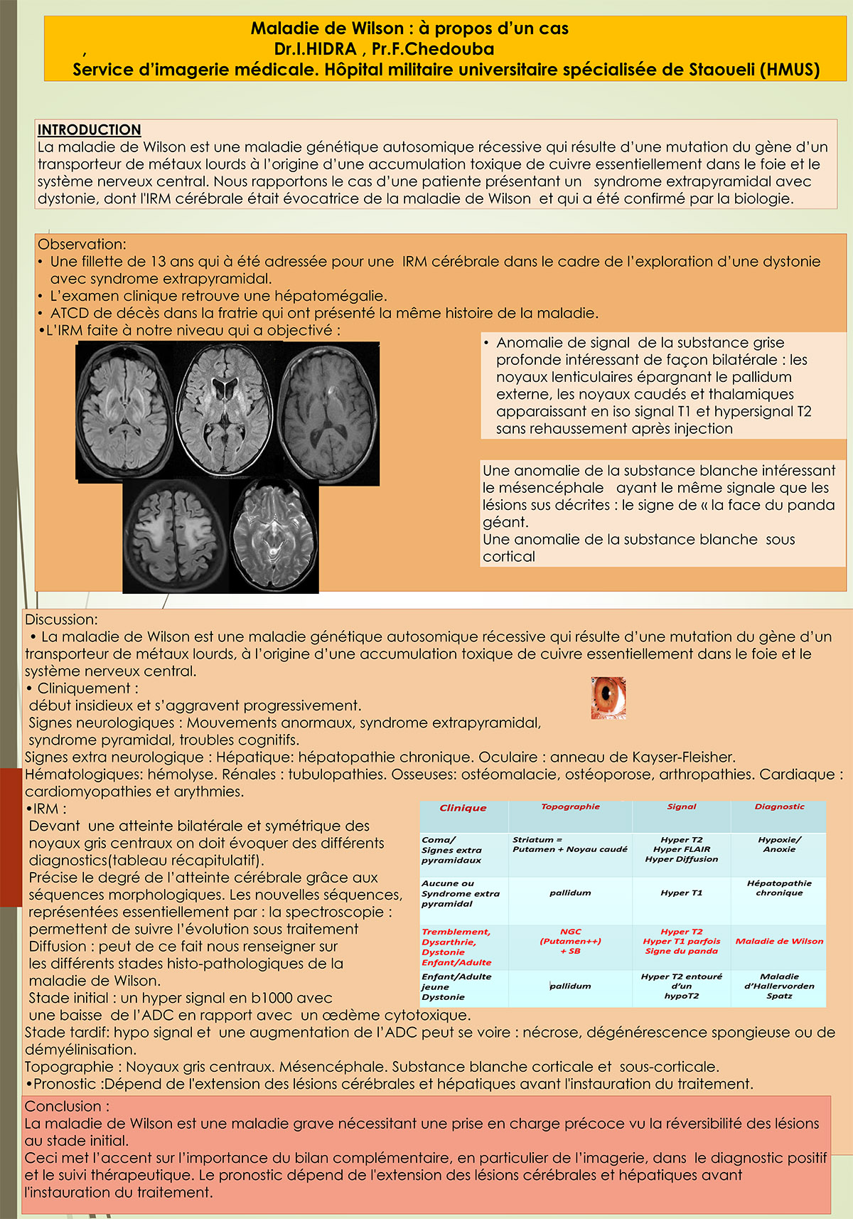 Maladie de Wilson à propos d’un cas Santedz