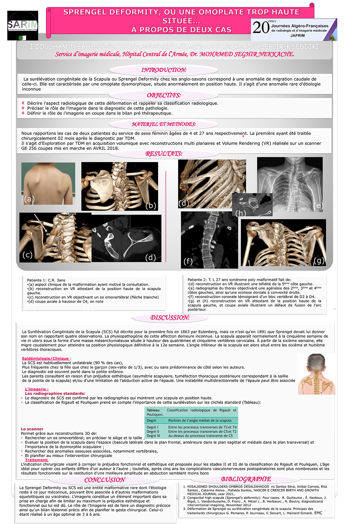 SPRENGEL DEFORMITY, OU UNE OMOPLATE TROP HAUTE SITUEE : A PROPOS D'UN CAS