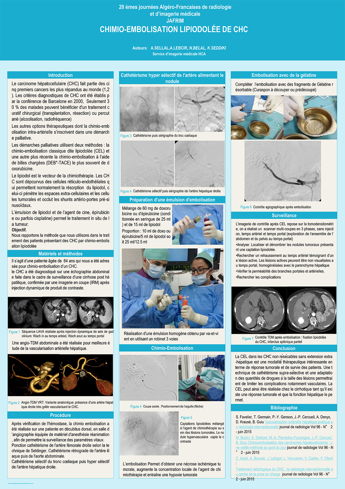 CHIMIO-EMBOLISATION LIPIODOLÉE DE CHC