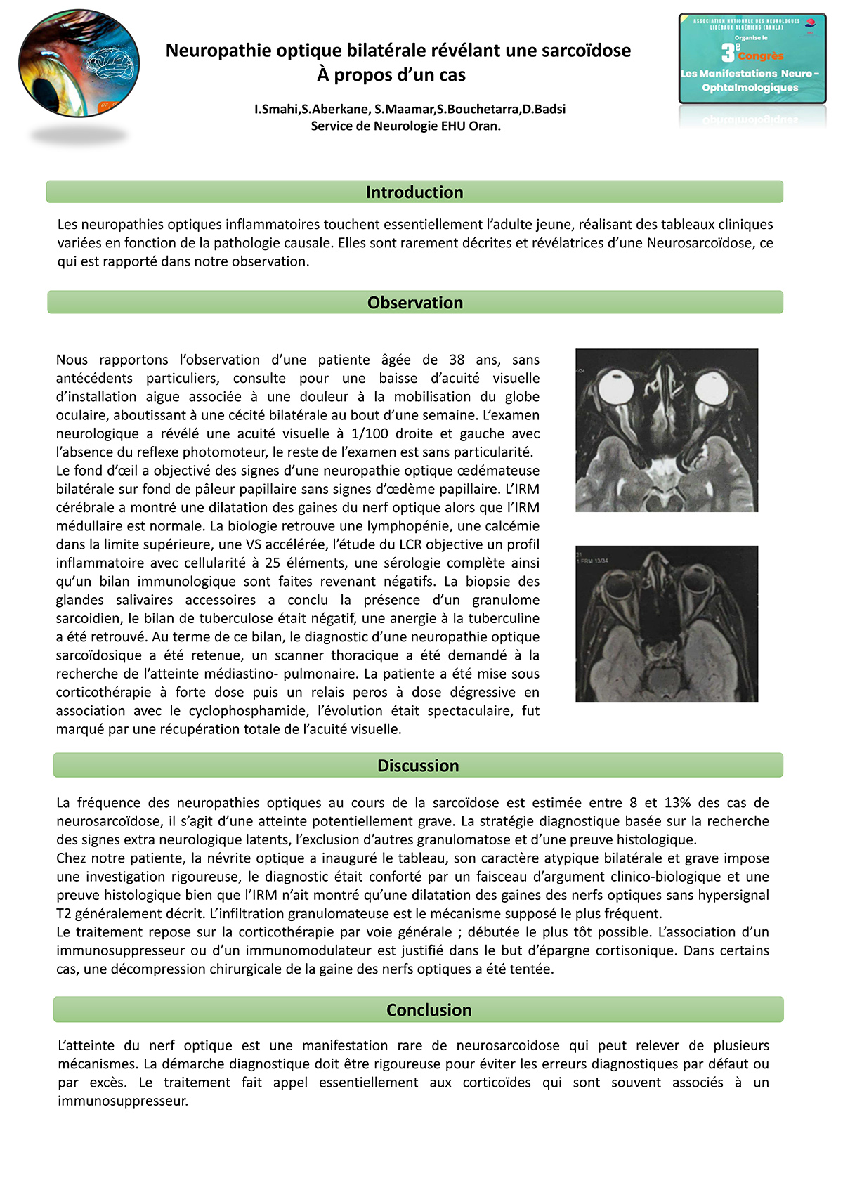 NO-6 Neuropathie optique bilatérale révélant une sarcoïdose: À propos d’un cas.